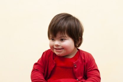 Down Syndrome Treatment