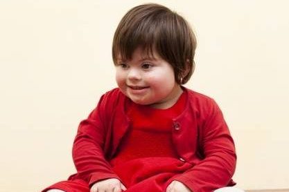 Down Syndrome Treatment